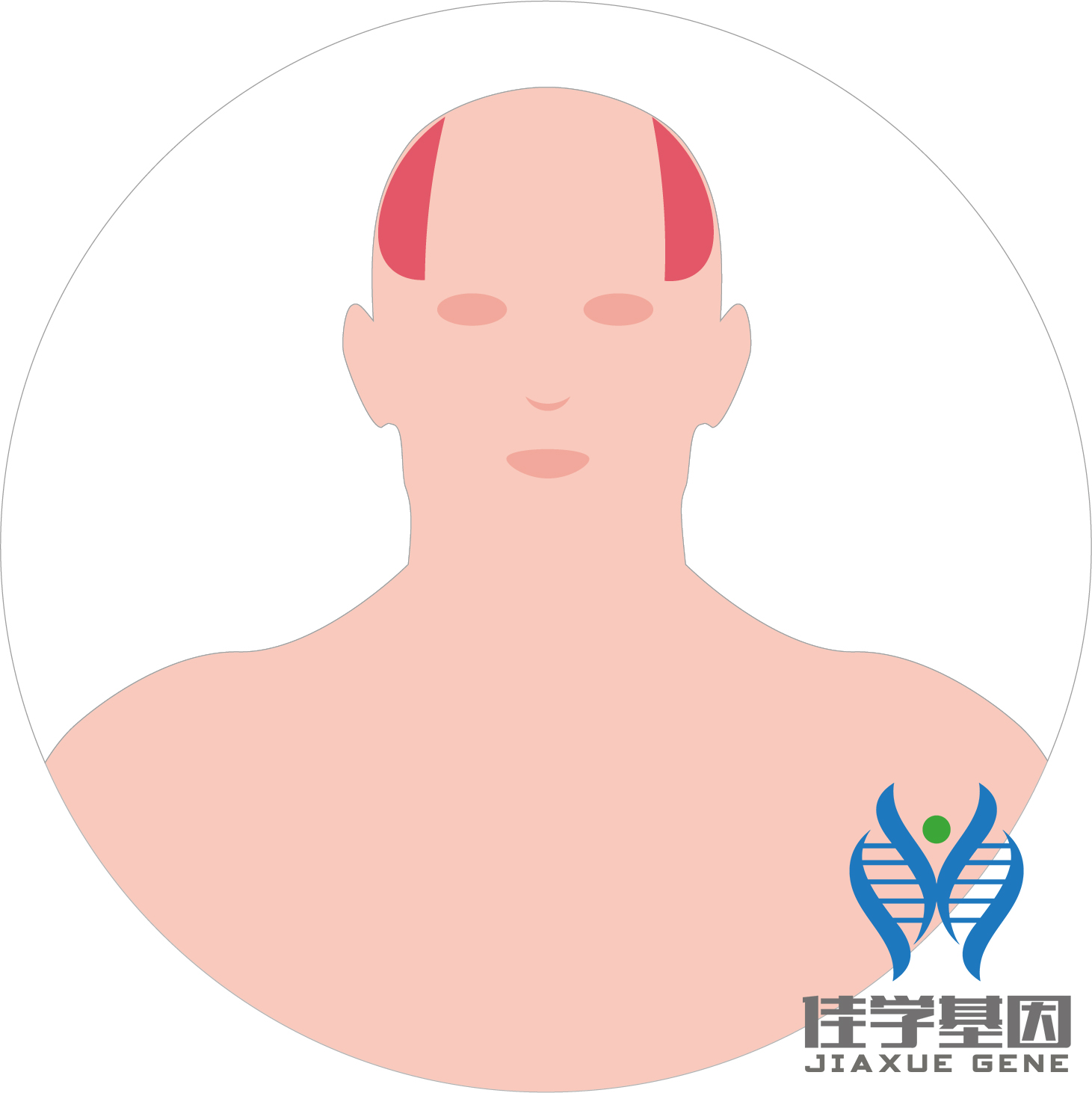 【佳學(xué)基因檢測(cè)】男性<font color='red'>脫發(fā)</font>（Androgenetic alopecia）基因解碼、<a href=http://m.lucasfraser.com/tk/jiema/cexujishu/2021/31933.html>基因檢測(cè)</a>