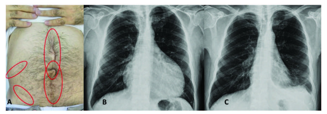 包含圖片、插圖等的外部文件。對象名稱為 turkjmedsci-50-1591-fig001.jpg